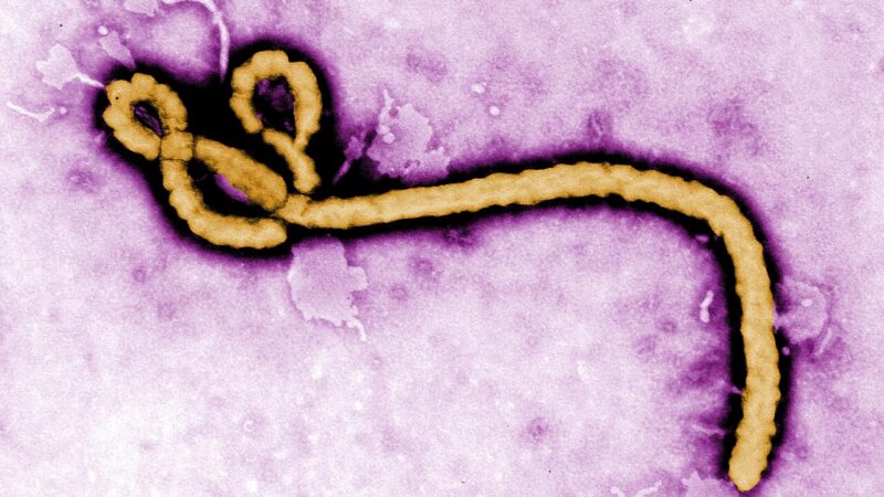 An electron micrograph of an Ebola virus particle