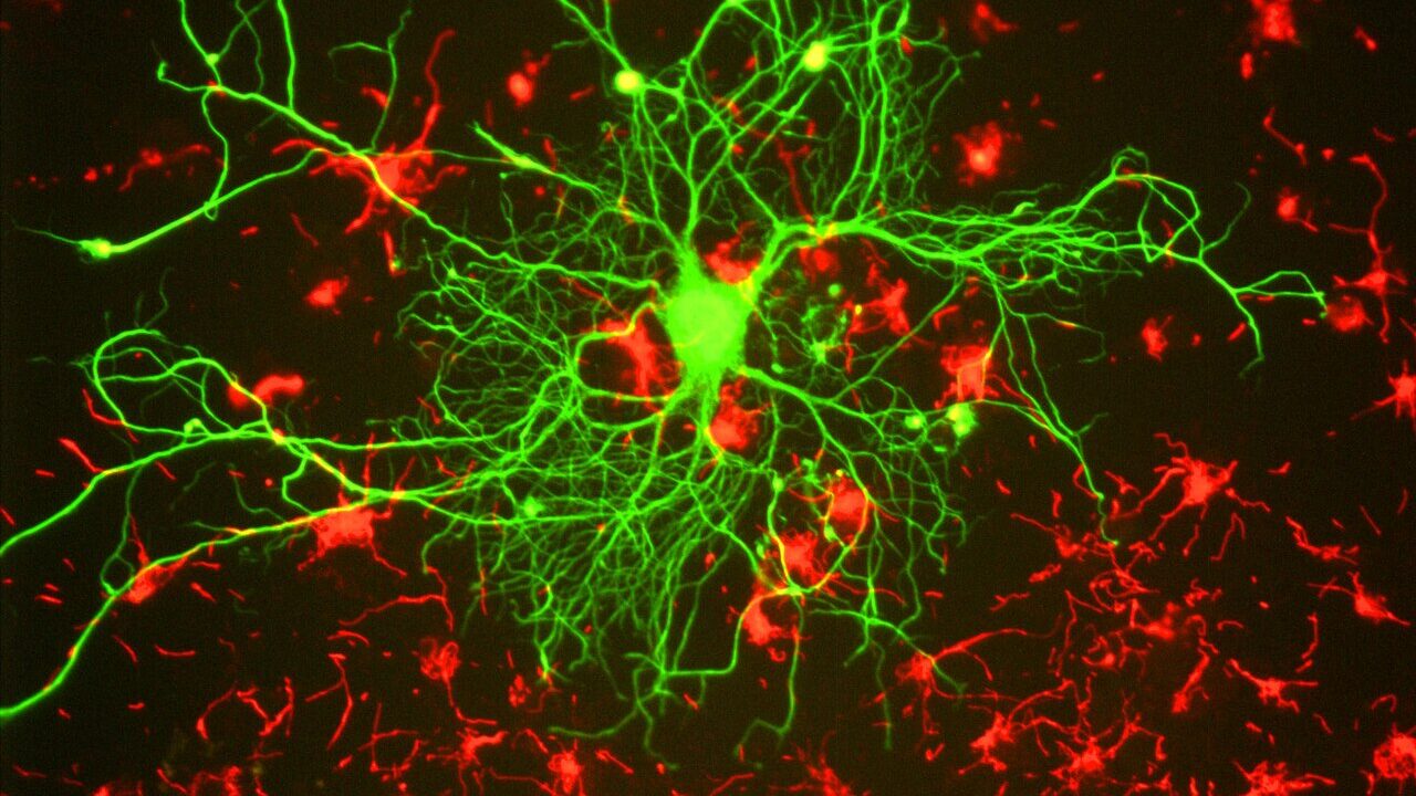 A neuron with branching processes growing in tissue culture