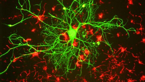 A neuron with branching processes growing in tissue culture